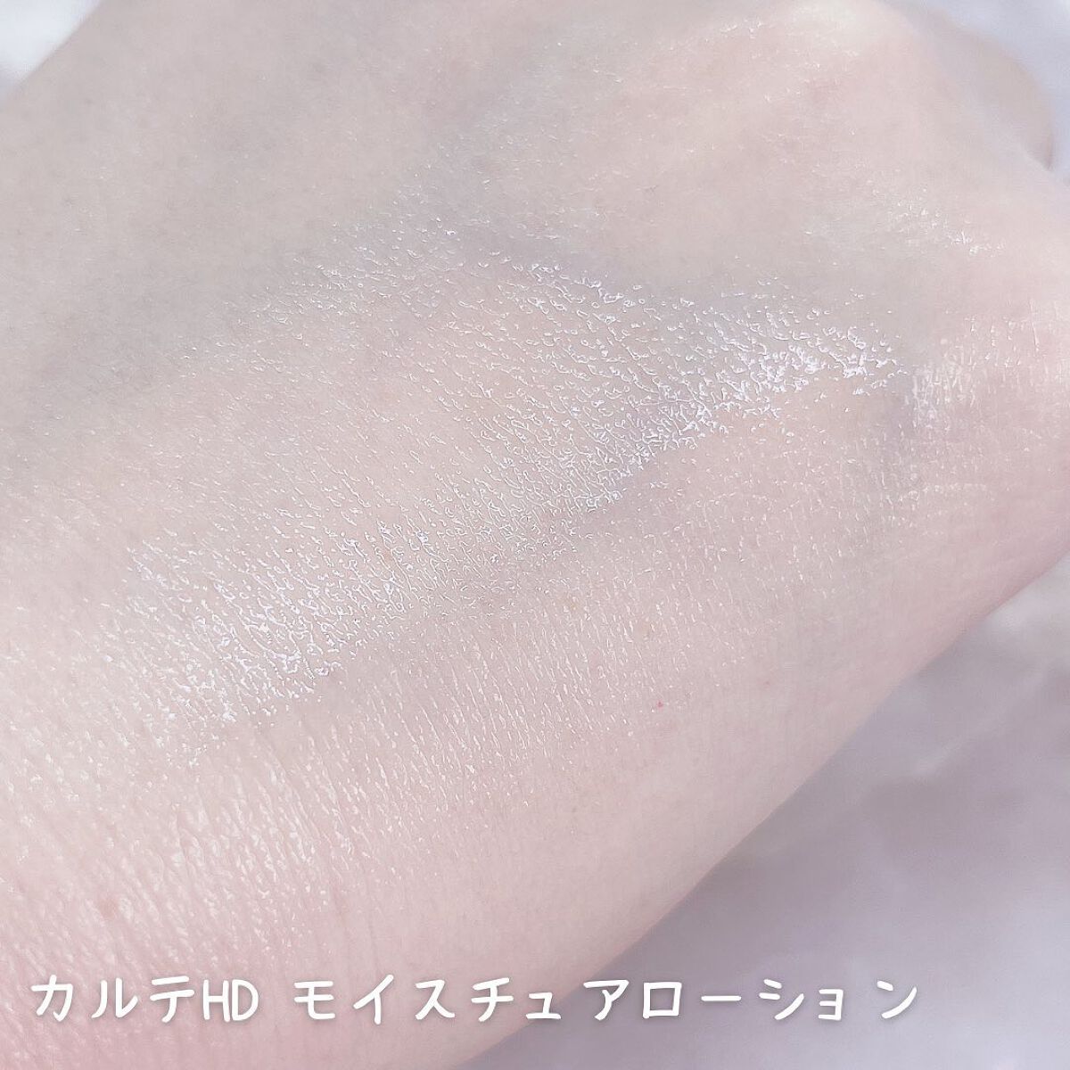 モイスチュア ローション/カルテHD/化粧水を使ったクチコミ(3枚目)