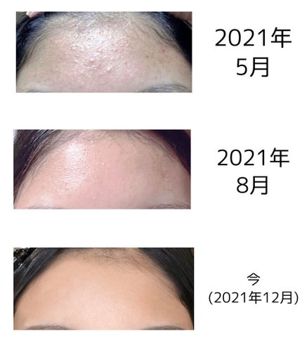 ミノン アミノモイスト モイストチャージ ミルク/ミノン/乳液を使ったクチコミ(4枚目)