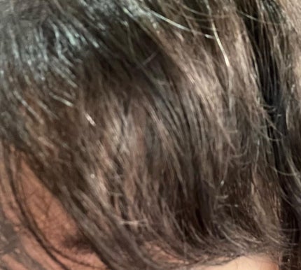 うるモイストインテンシブオイルセラム/byTREES/美容液を使ったクチコミ(6枚目)