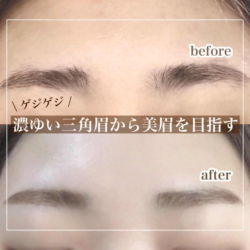 プレミア敏感肌用 Lディスポ/シック/シェーバーを使ったクチコミ(1枚目)