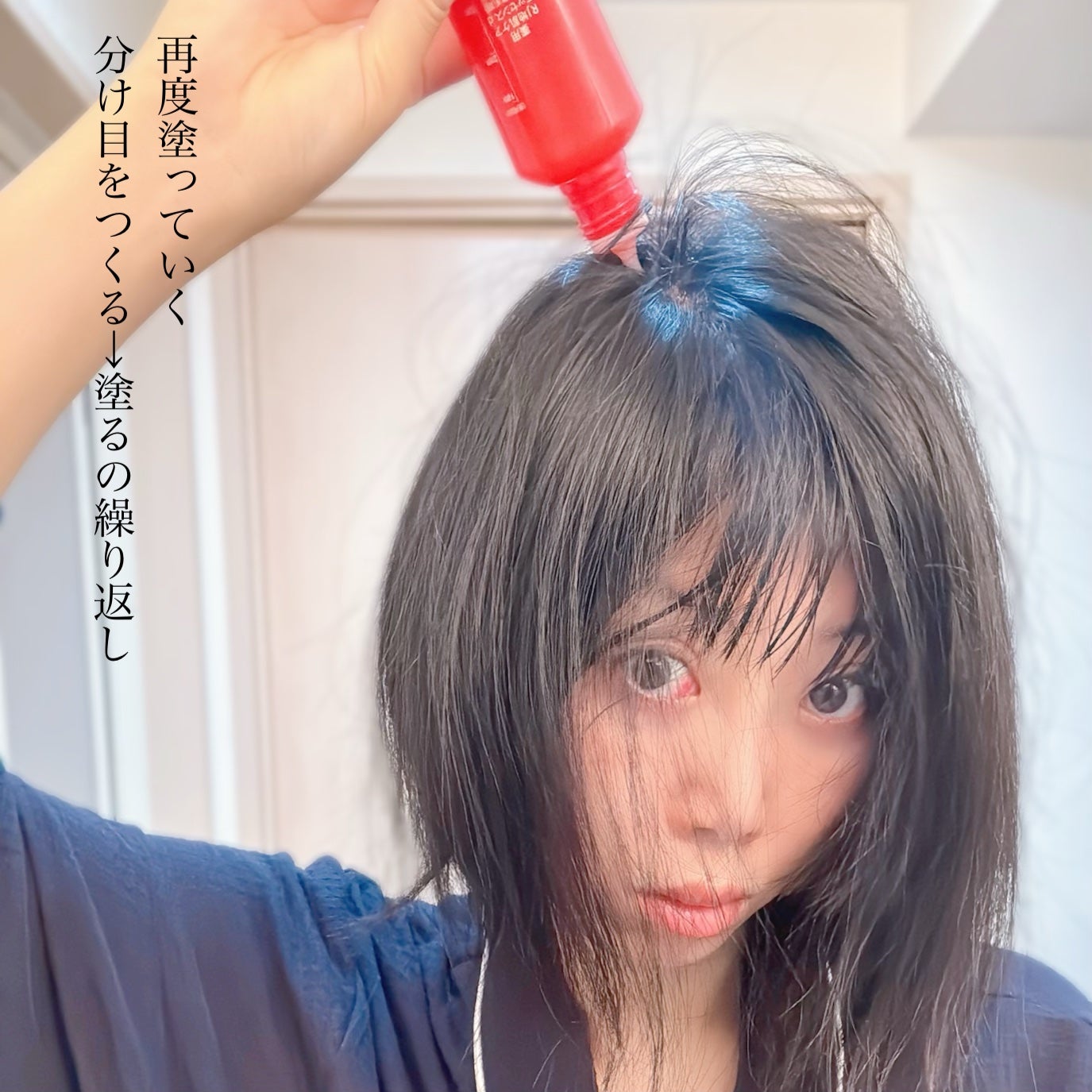 薬用 RJ地肌ケア エッセンス /アピセラピーコスメティクス/頭皮ローションを使ったクチコミ(7枚目)