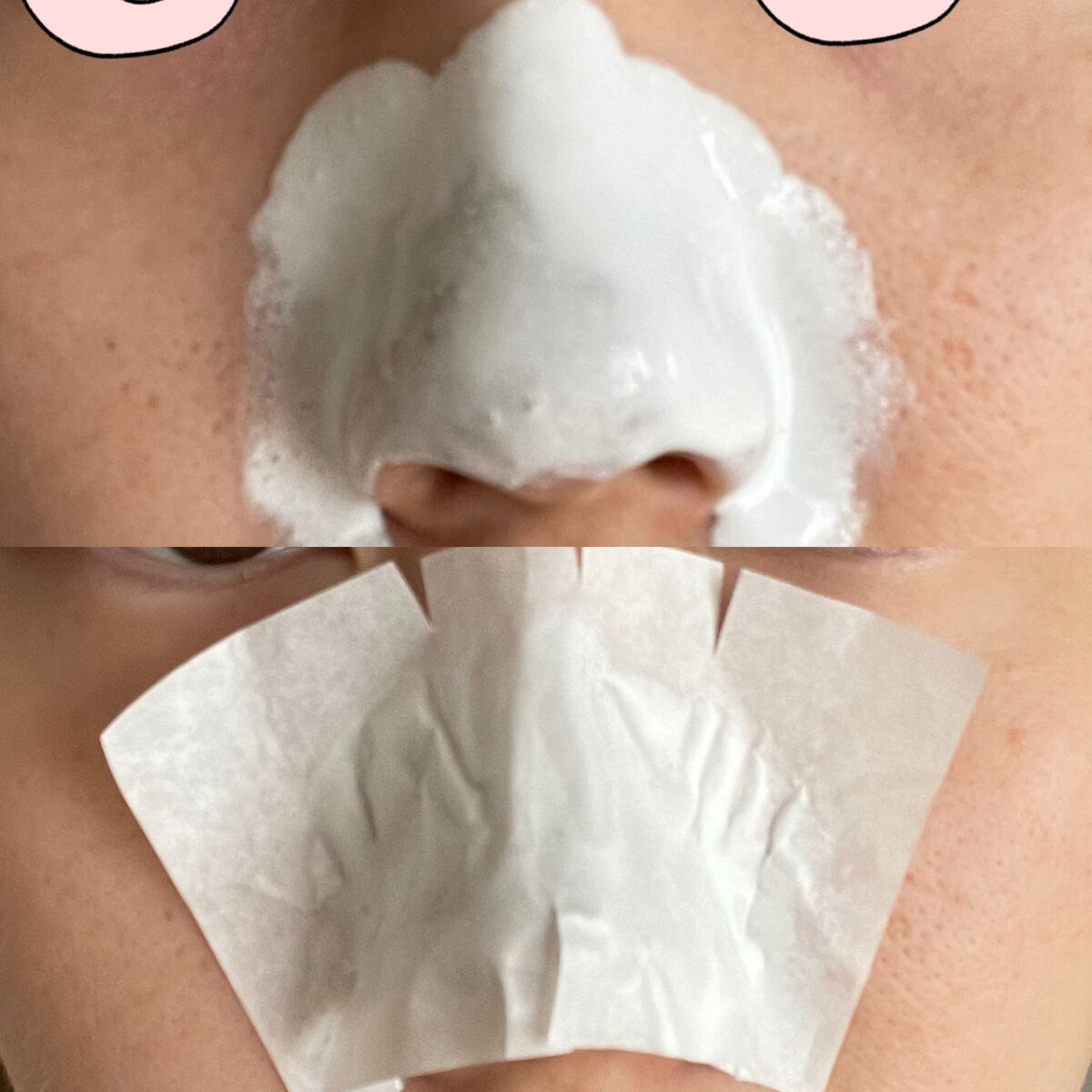 ゼロ毛穴パッド 2.0/MEDICUBE/トナーパッドを使ったクチコミ（3枚目）