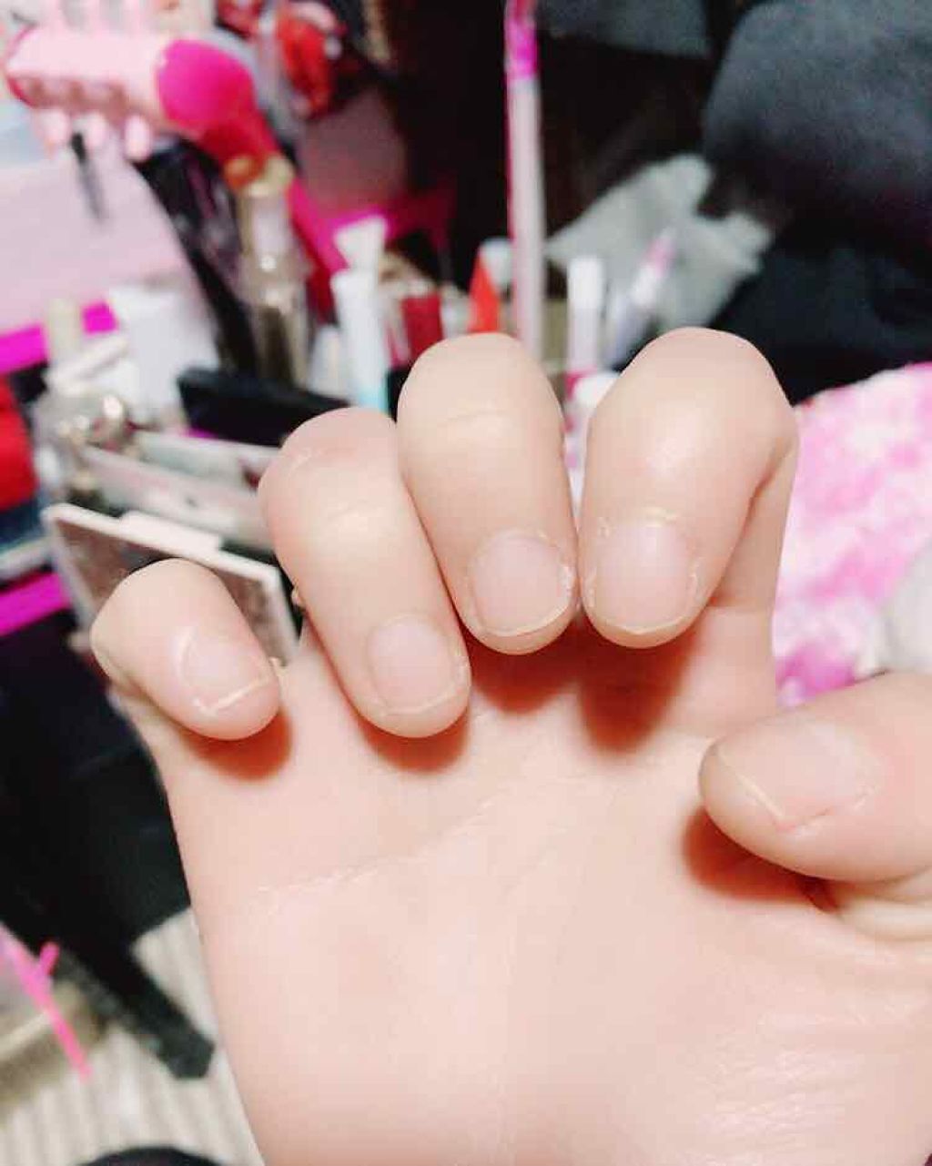 ネイルポリッシュリムーバー EX/D-UP/除光液を使ったクチコミ（2枚目）