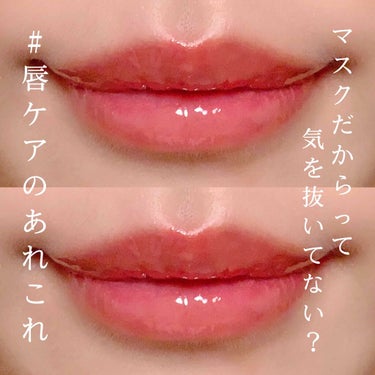 BubiBubi Lip/unpa/リップケア・リップクリームを使ったクチコミ（1枚目）