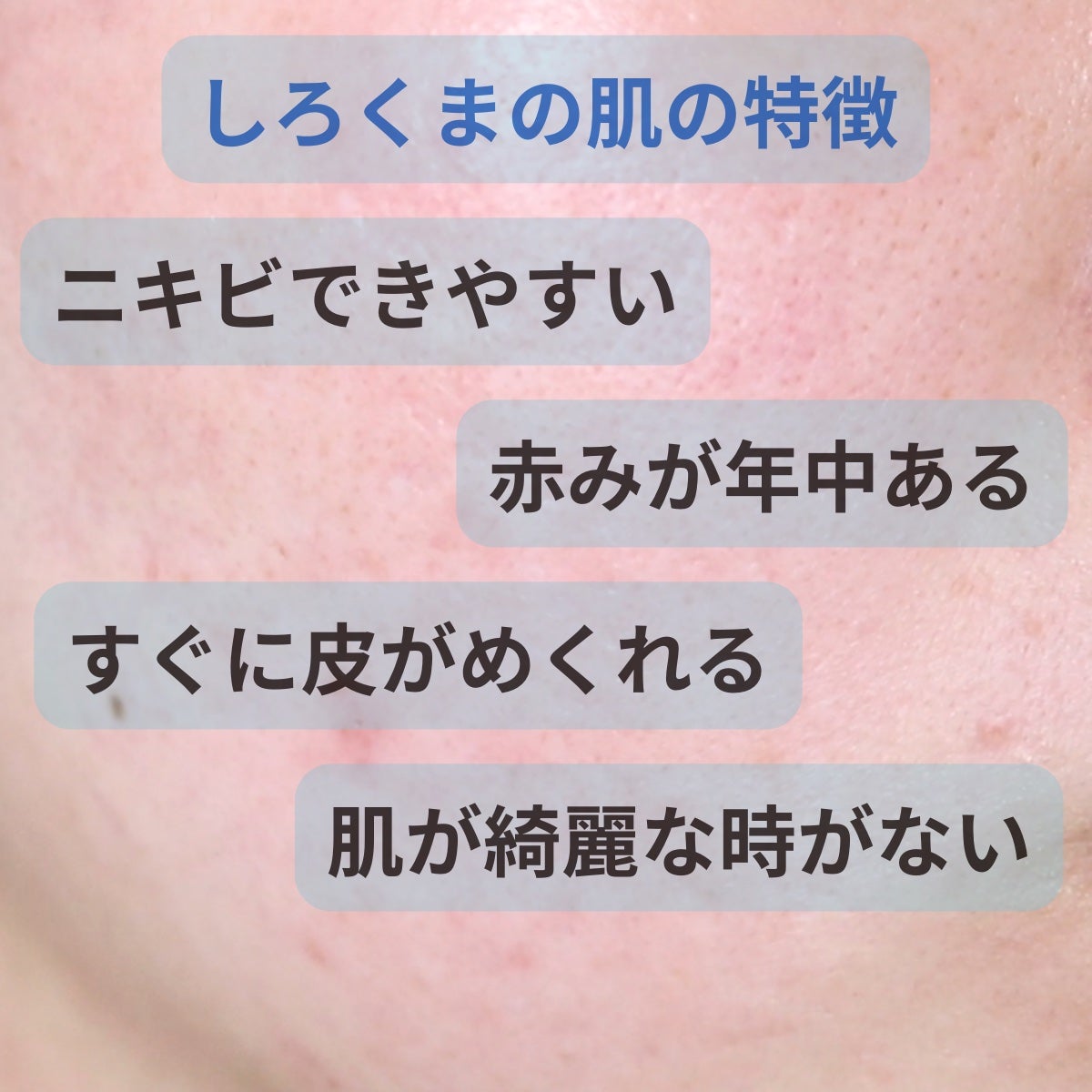 パンテトイン エッセンス トナー/manyo/化粧水を使ったクチコミ(4枚目)