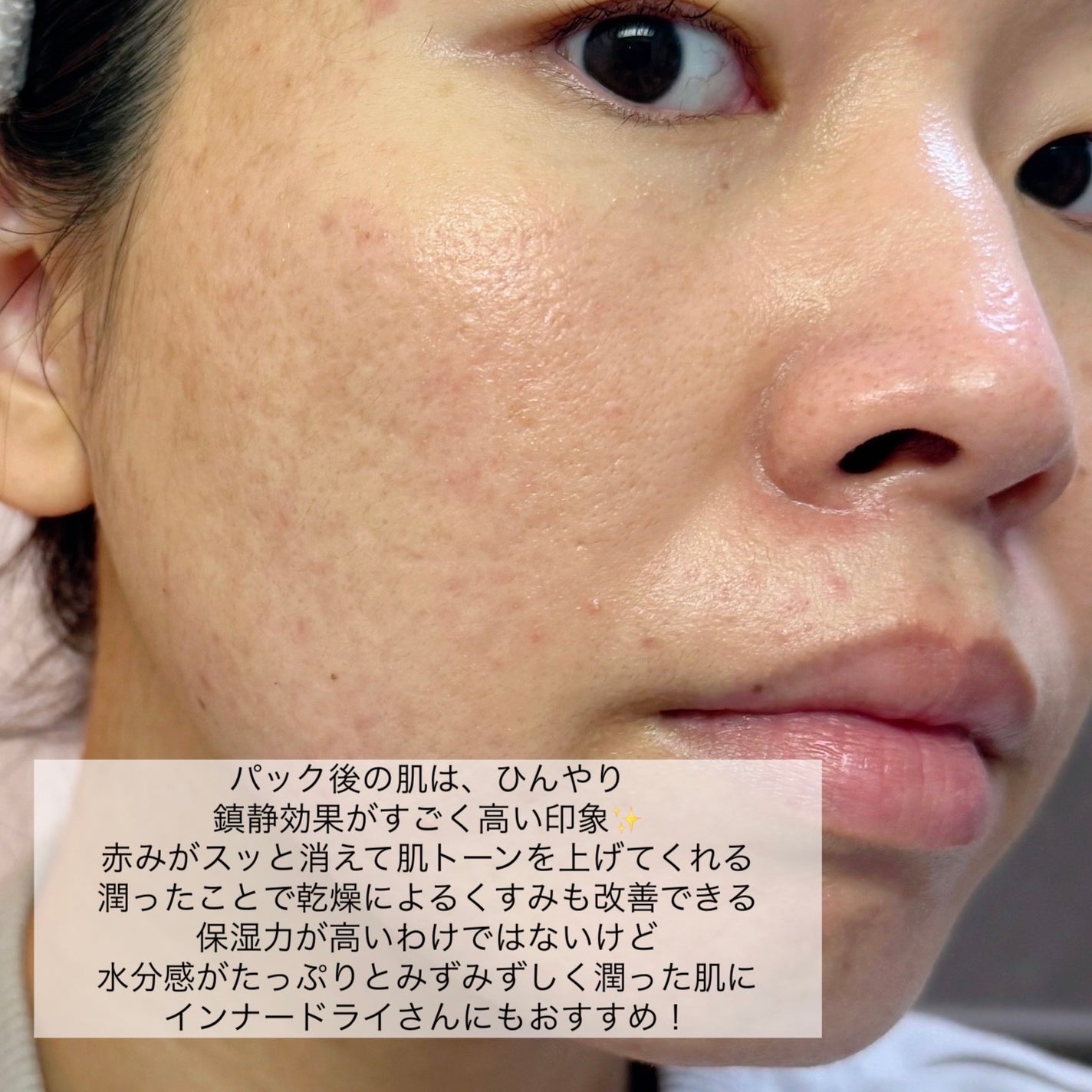 シカフルカーミングマスク/beplain/シートマスク・パックを使ったクチコミ(8枚目)