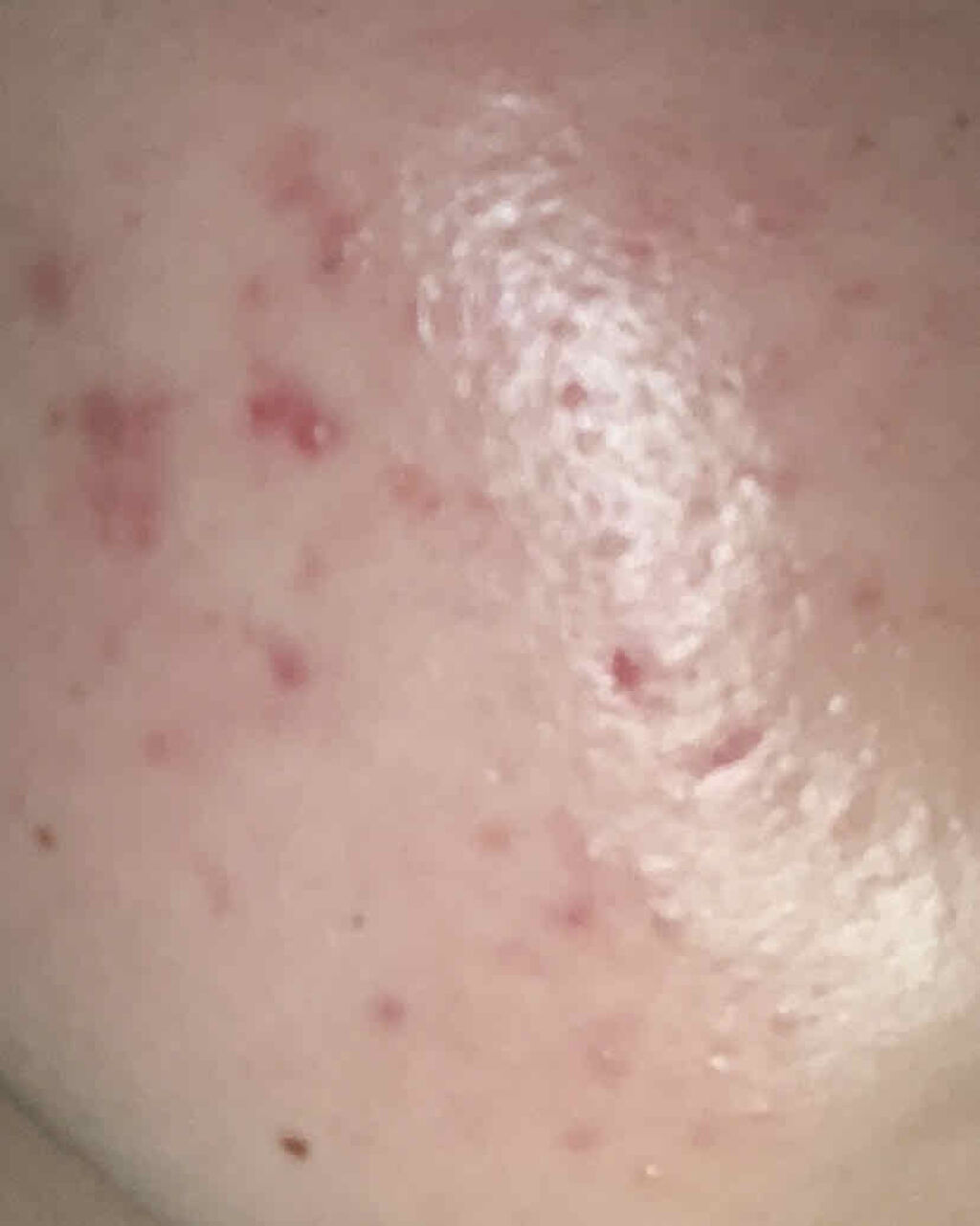 キールズ DS クリアリーブライト エッセンス[医薬部外品]/Kiehl's/美容液を使ったクチコミ（2枚目）