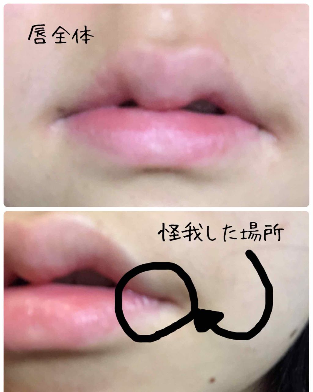 を使ったクチコミ（2枚目）