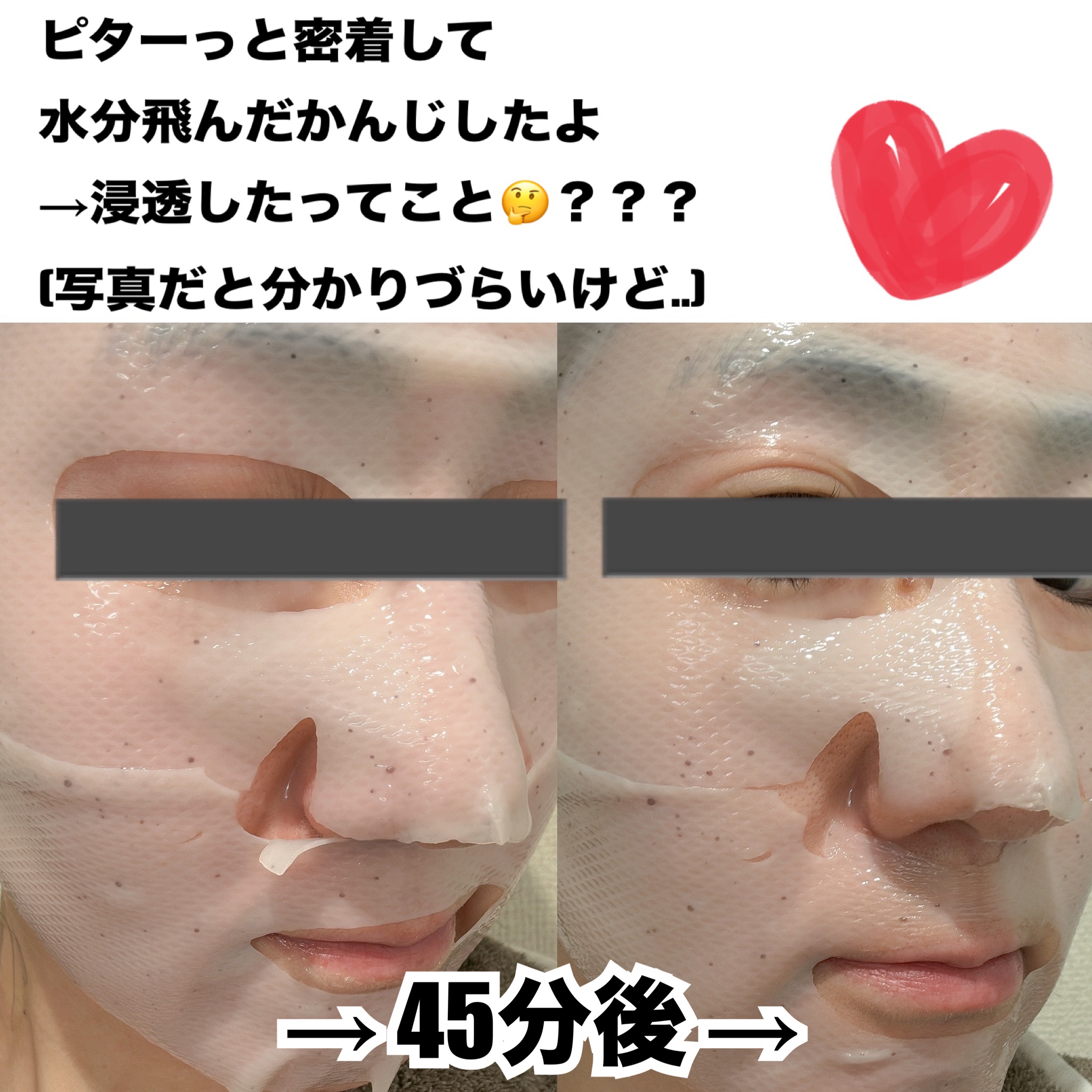 バイオヒールボ プロバイオダーム™ コラーゲンリモデリングゲルマスク/BIOHEAL BOH/シートマスク・パックを使ったクチコミ（2枚目）