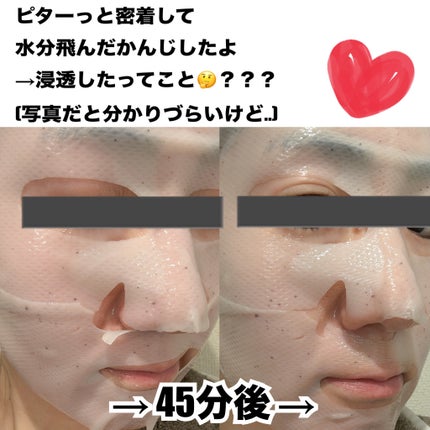 バイオヒールボ プロバイオダーム™ コラーゲンリモデリングゲルマスク/BIOHEAL BOH/シートマスク・パックを使ったクチコミ(2枚目)