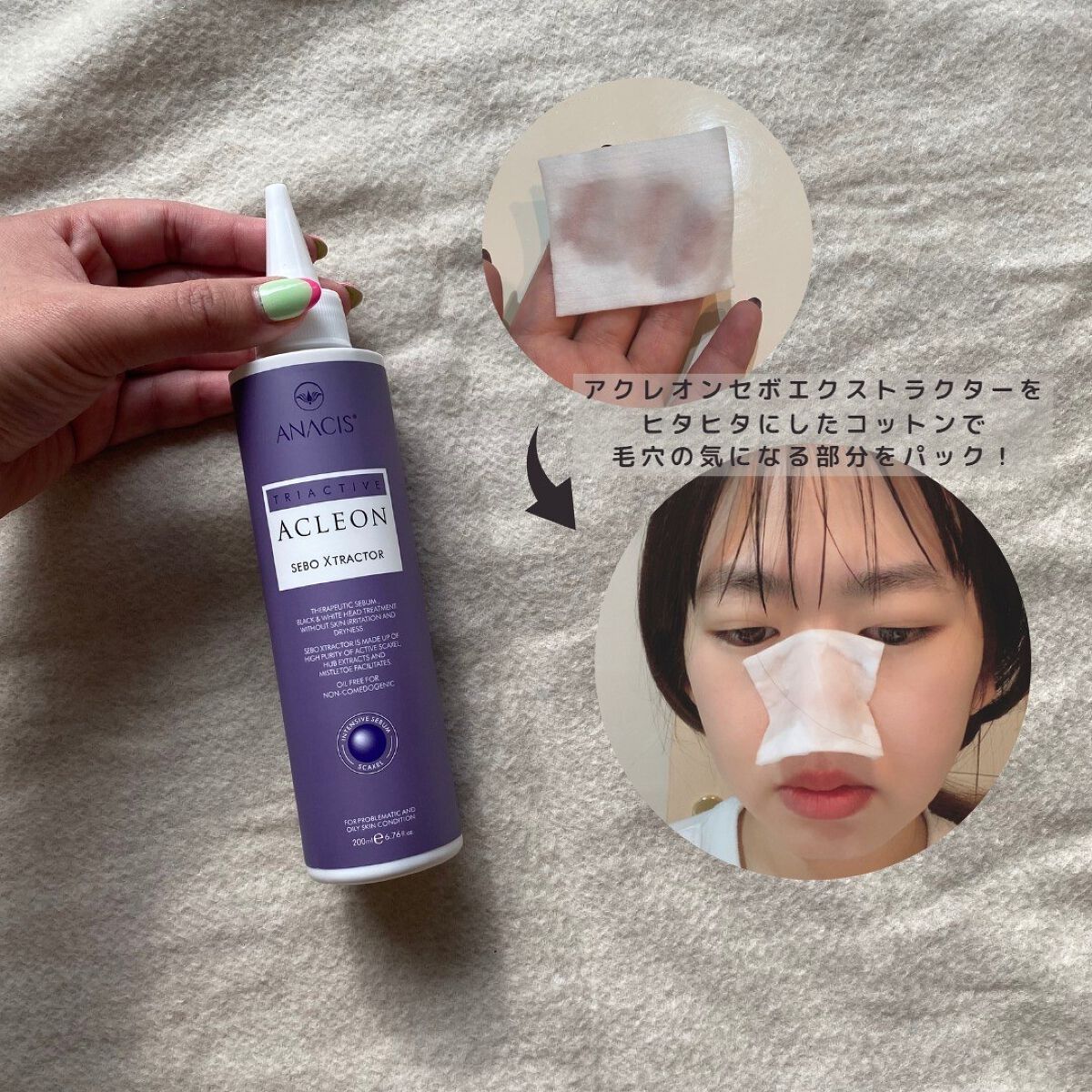 アクレオンセボエクストラクター/ANACIS/その他スキンケアを使ったクチコミ(2枚目)
