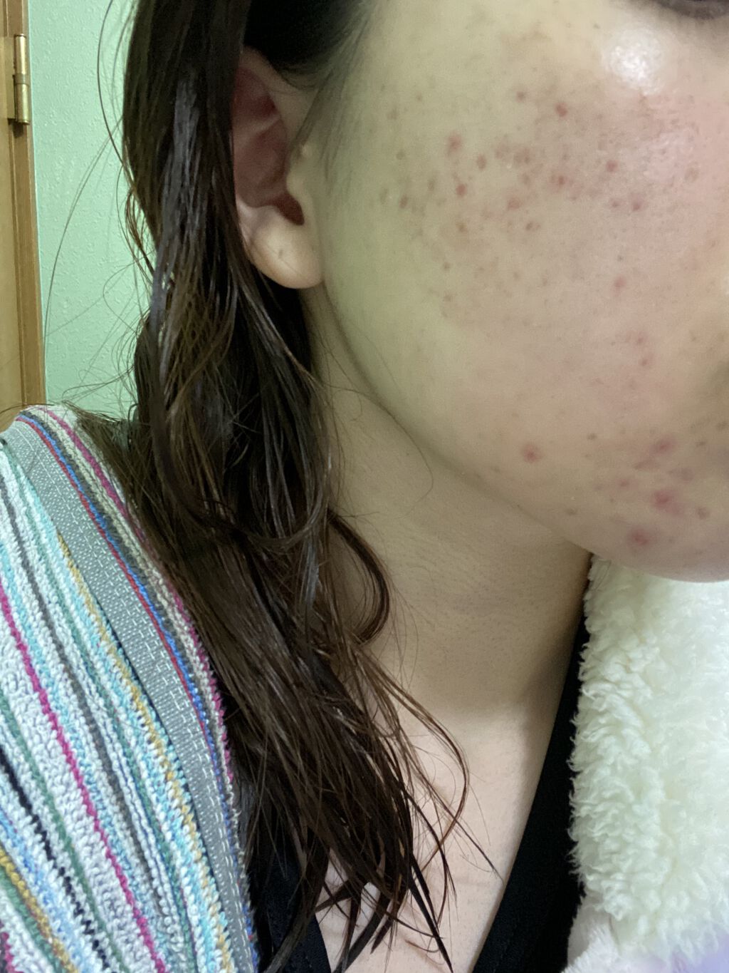 ハトムギ化粧水(ナチュリエ スキンコンディショナー R )/ナチュリエ/化粧水を使ったクチコミ（2枚目）