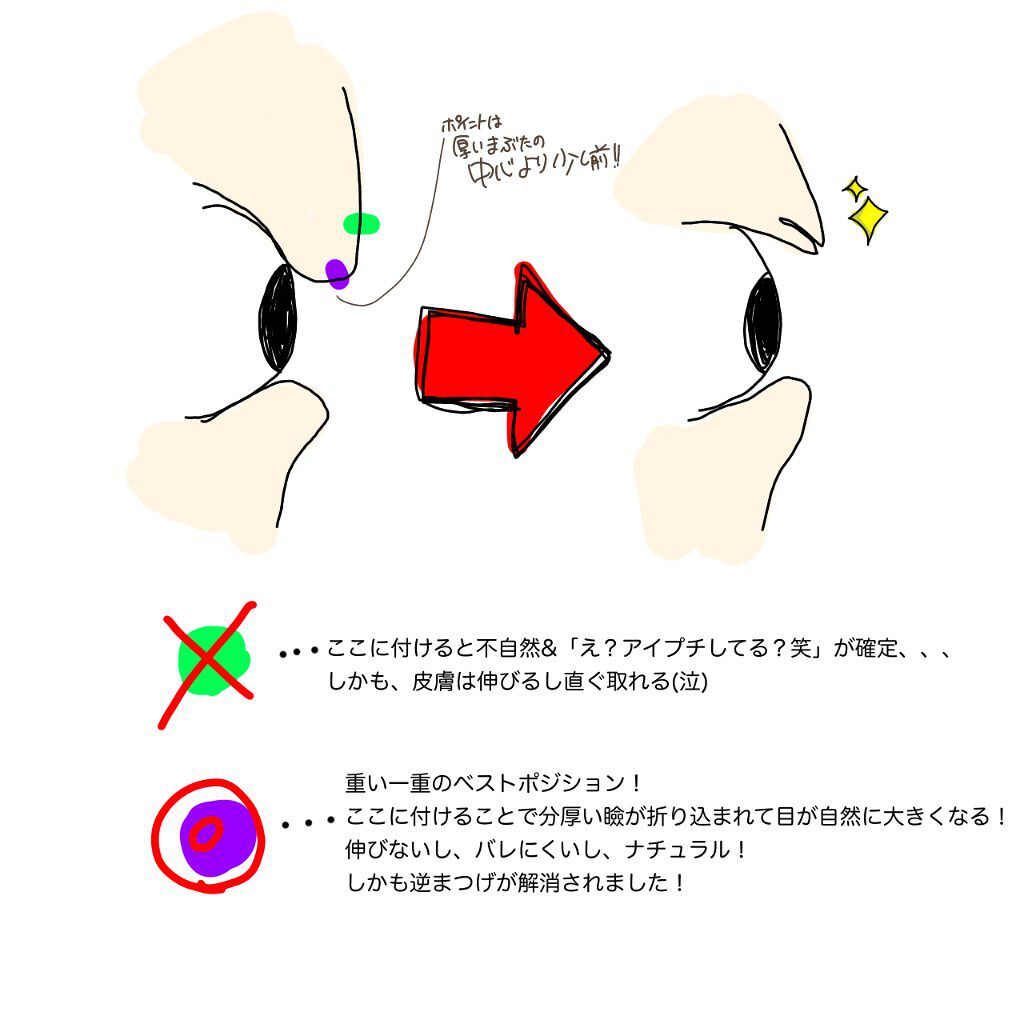 ワンダーアイリッドテープ Extra/D-UP/二重まぶた用アイテムを使ったクチコミ（3枚目）