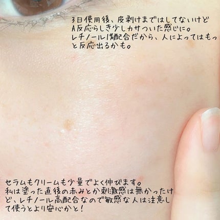 レチノールインテンシブ アドバンスドトリプルアクションアイクリーム/SOME BY MI/アイケア・アイクリームを使ったクチコミ(4枚目)