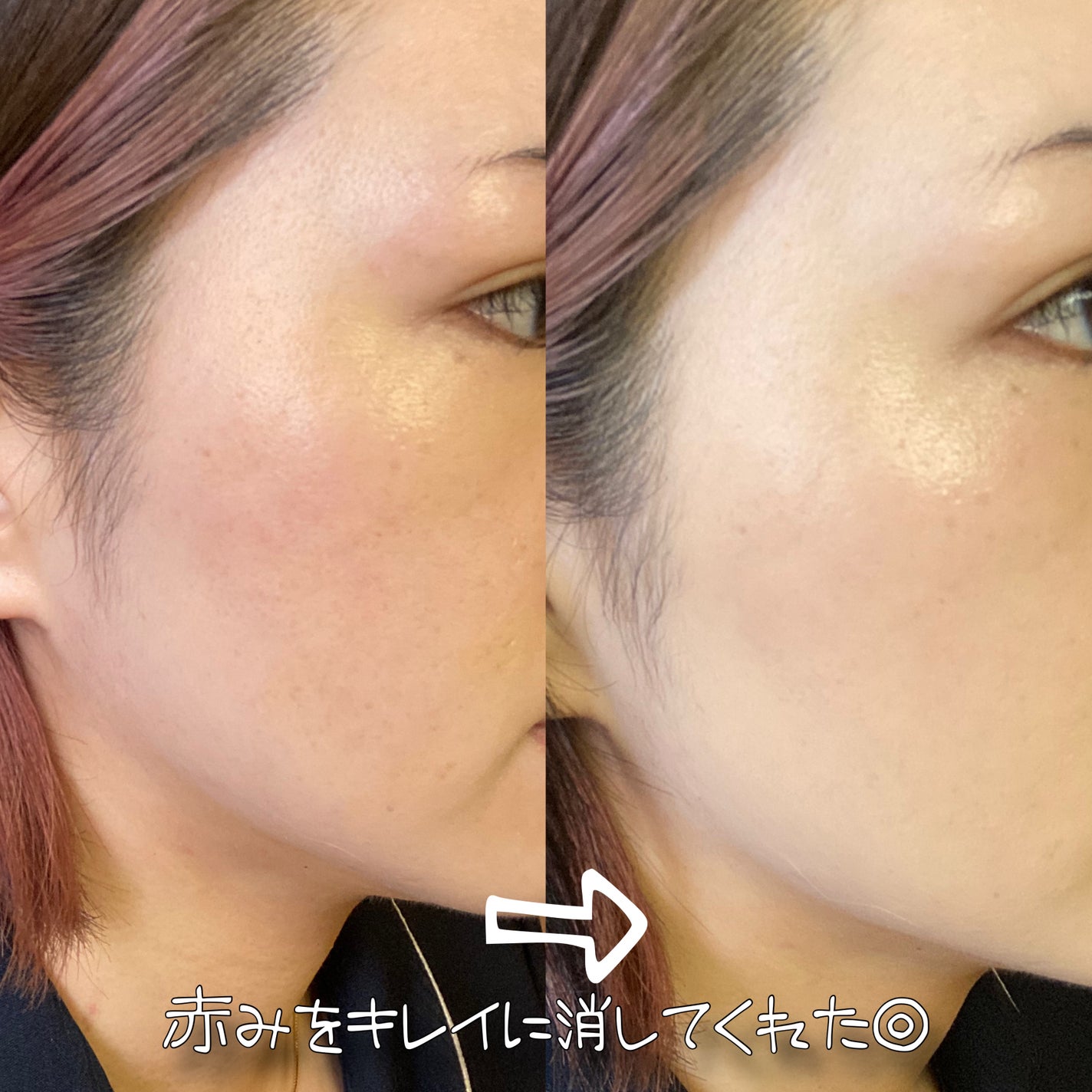 レイヤリングフィット グロークッションEX/TFIT/クッションファンデーションを使ったクチコミ(6枚目)