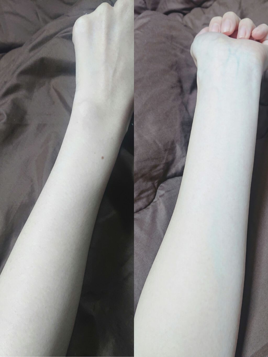 薬用しみ対策 美白化粧水/メラノCC/化粧水を使ったクチコミ（3枚目）