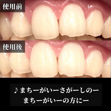 ホワイトニングスポンジ/キャンドゥ/その他オーラルケアを使ったクチコミ(6枚目)