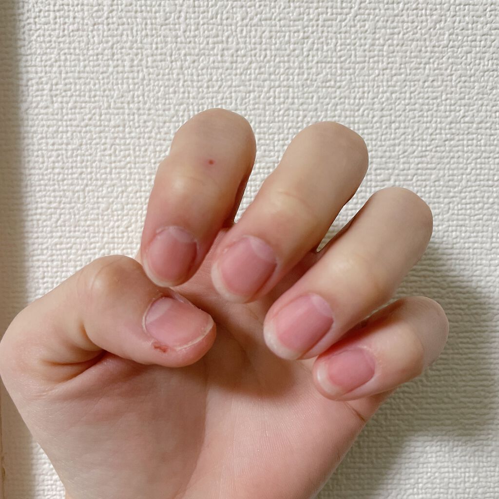 ディーアップファンデーション/D-UP/ネイルベースコートを使ったクチコミ（2枚目）