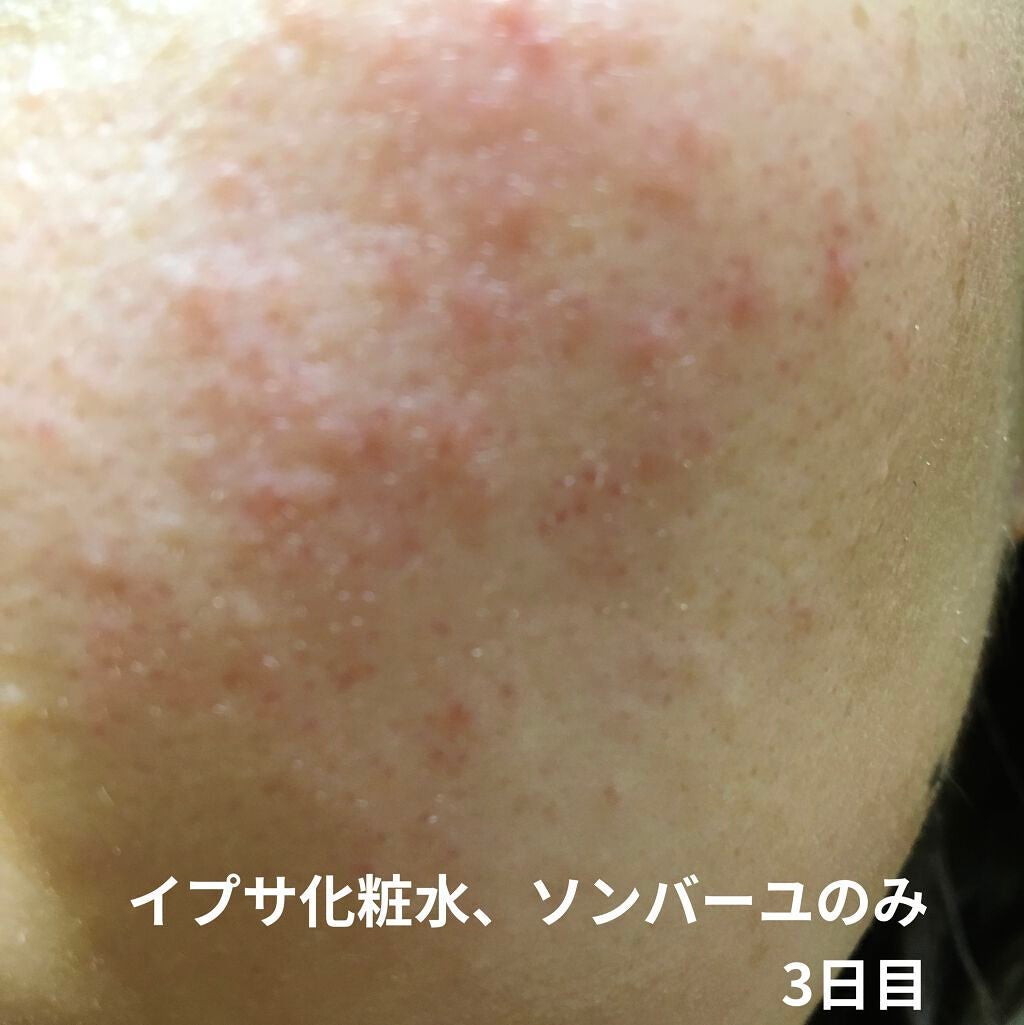 スチーマー ナノケア EH-SA0B/Panasonic/美顔器・マッサージを使ったクチコミ(1枚目)