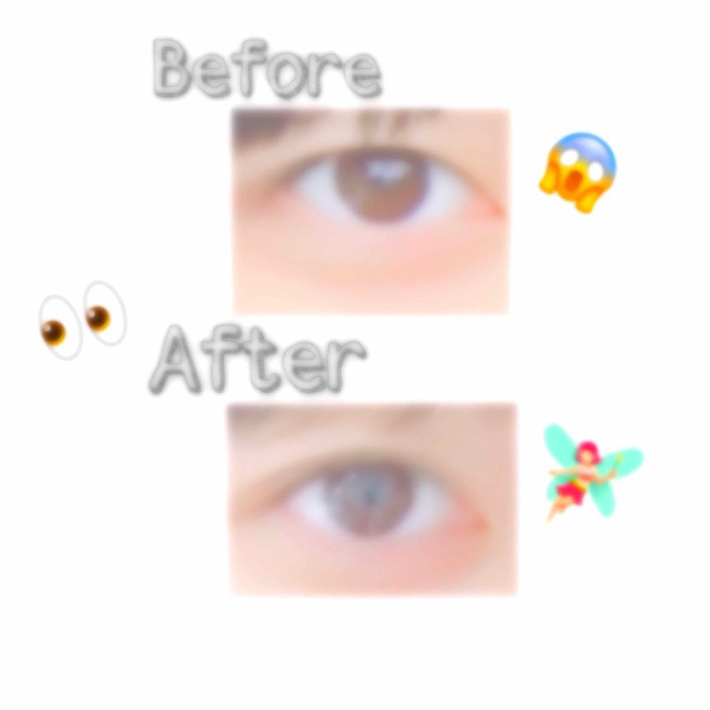 アイトーク/アイトーク/二重まぶた用アイテムを使ったクチコミ(1枚目)