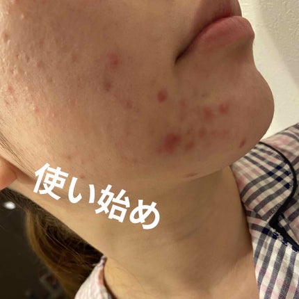 ルルルンプレシャス WHITE(光彩スイッチ)/ルルルン/シートマスク・パックを使ったクチコミ(1枚目)