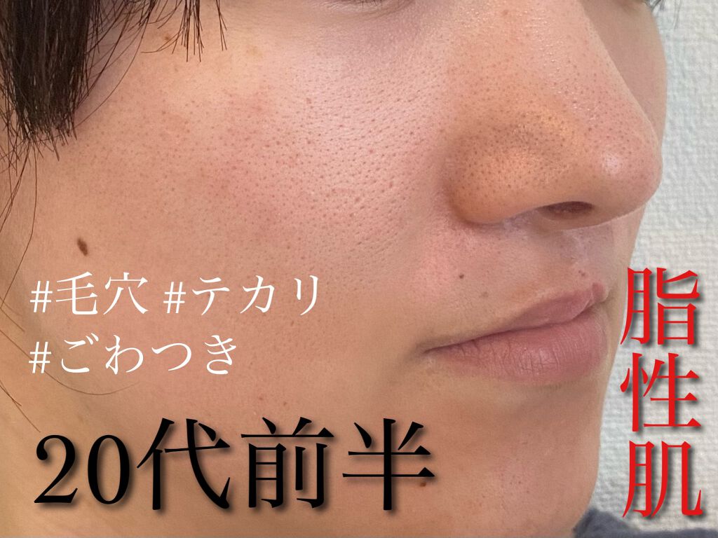 モイスチャライジングセラム/エトヴォス/美容液を使ったクチコミ（1枚目）