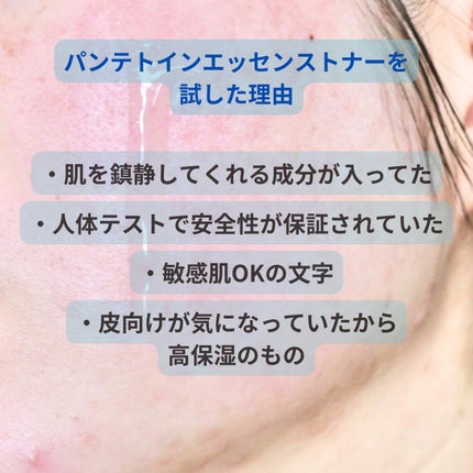 パンテトイン エッセンス トナー/manyo/化粧水を使ったクチコミ(2枚目)