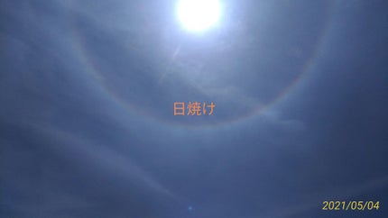 HARUNA on LIPS 「夏になると日焼けをしてしまいますよね💦そのため多くの方は日焼け..」(1枚目)