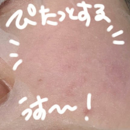 CICA デイリースージングマスク/VT/シートマスク・パックを使ったクチコミ(2枚目)