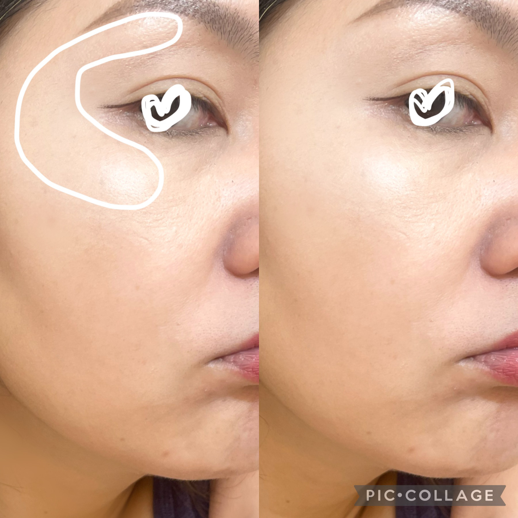 アテニア グロウハイライトのクチコミ「主張し過ぎないハイライトなので、
デイリー用にオススメ
パール感がキレイ

◾️商品
#アテニ.....」（3枚目）