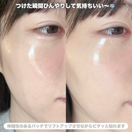 グルタチオンダークゼロトーニングパッチ/SNP/アイケア・アイクリームを使ったクチコミ(6枚目)