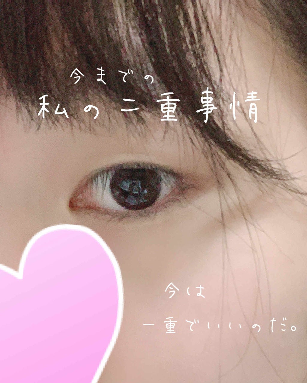 アイテープ片面(のびる)絆創膏タイプ スリム 120枚/セリア/二重まぶた用アイテムを使ったクチコミ(1枚目)