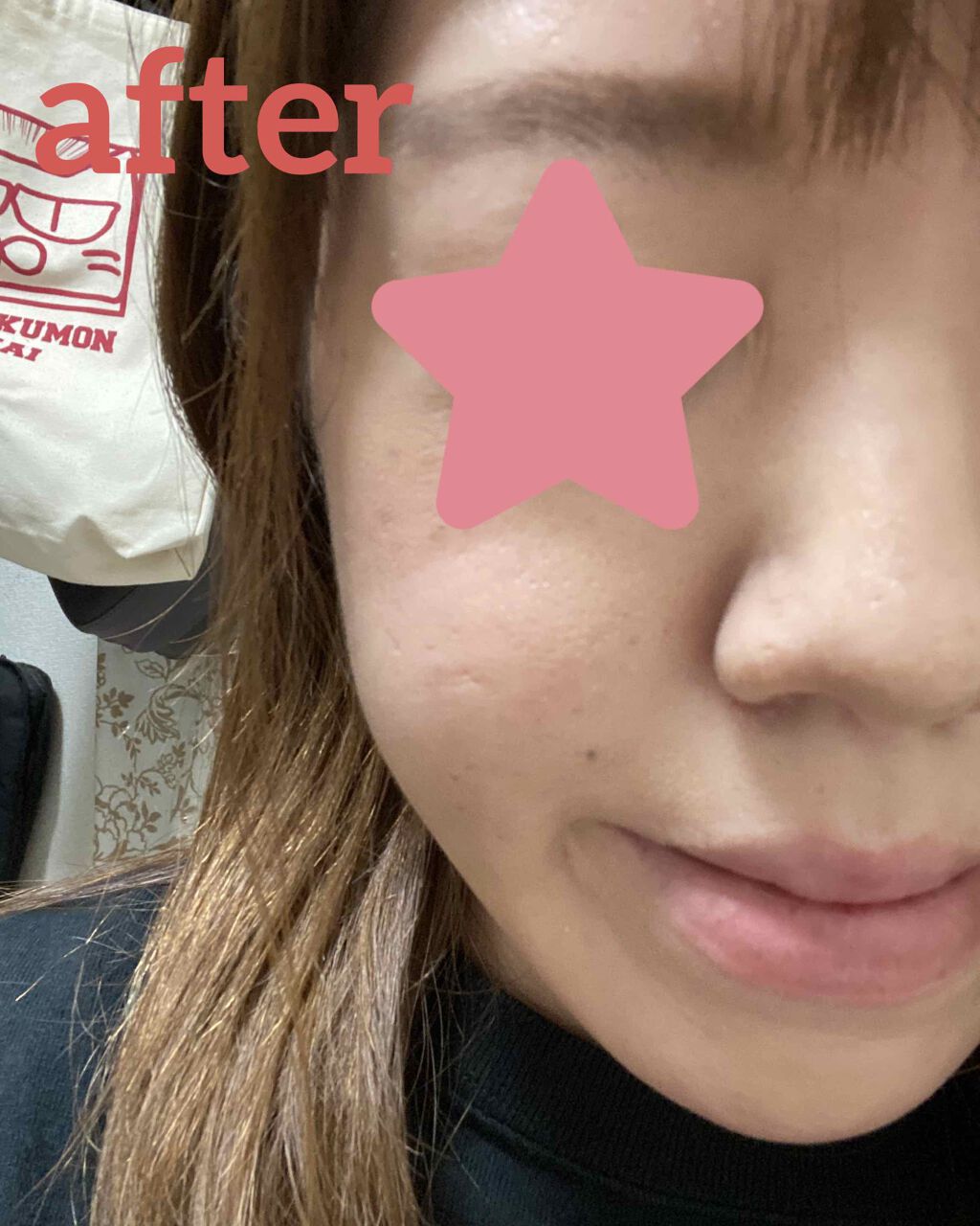 ホワイト パウダレスト/ALBION/パウダーファンデーションを使ったクチコミ（3枚目）