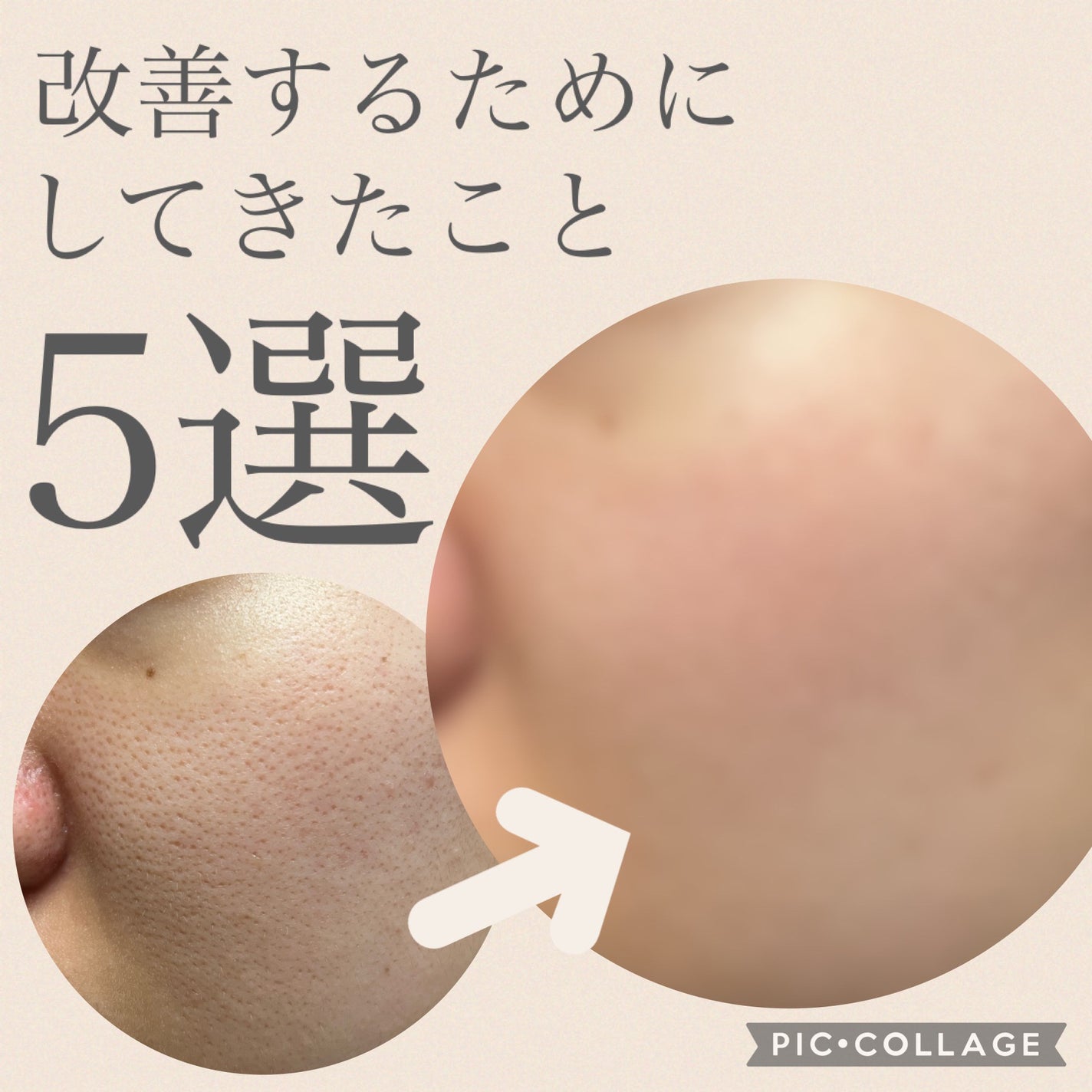 ケアセラ APフェイス&ボディ乳液/ケアセラ/ボディミルクを使ったクチコミ(1枚目)