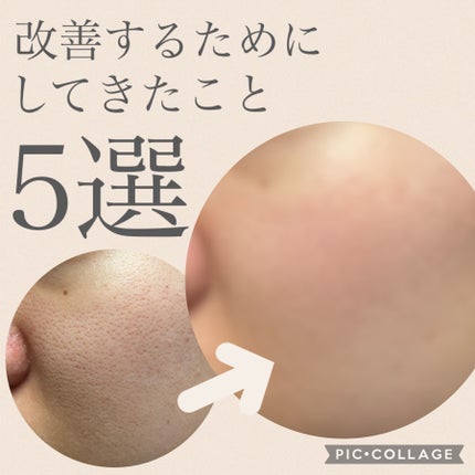 レッドB・Cスージングクリーム(チューブタイプ)/Dr.G/フェイスクリームを使ったクチコミ(1枚目)