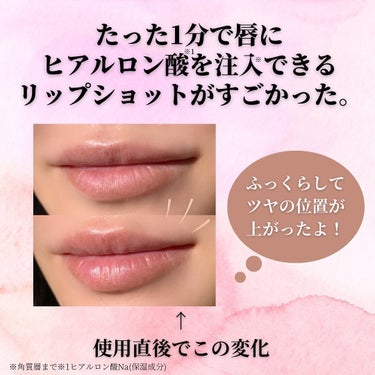 LIPS SHOT/MOTTO LAB./リップケア・リップクリームを使ったクチコミ（2枚目）