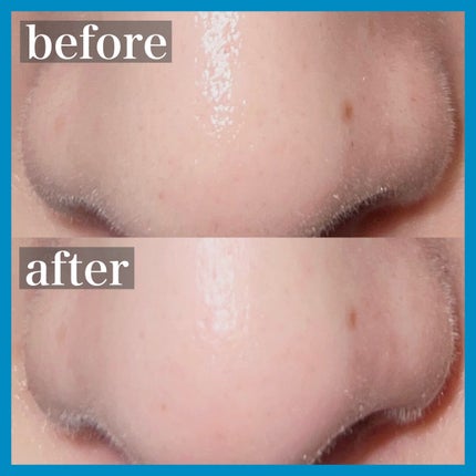 ゼロ毛穴パッド 2.0/MEDICUBE/トナーパッドを使ったクチコミ(1枚目)