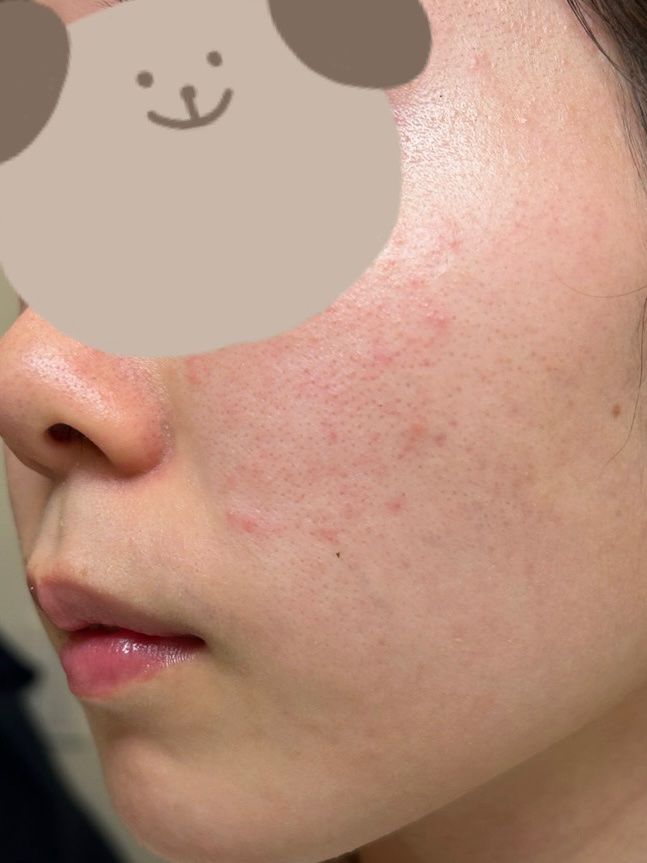 ビオレ おうちdeエステ メイク落とし マッサージブラックジェル/ビオレ/クレンジングジェルを使ったクチコミ（2枚目）