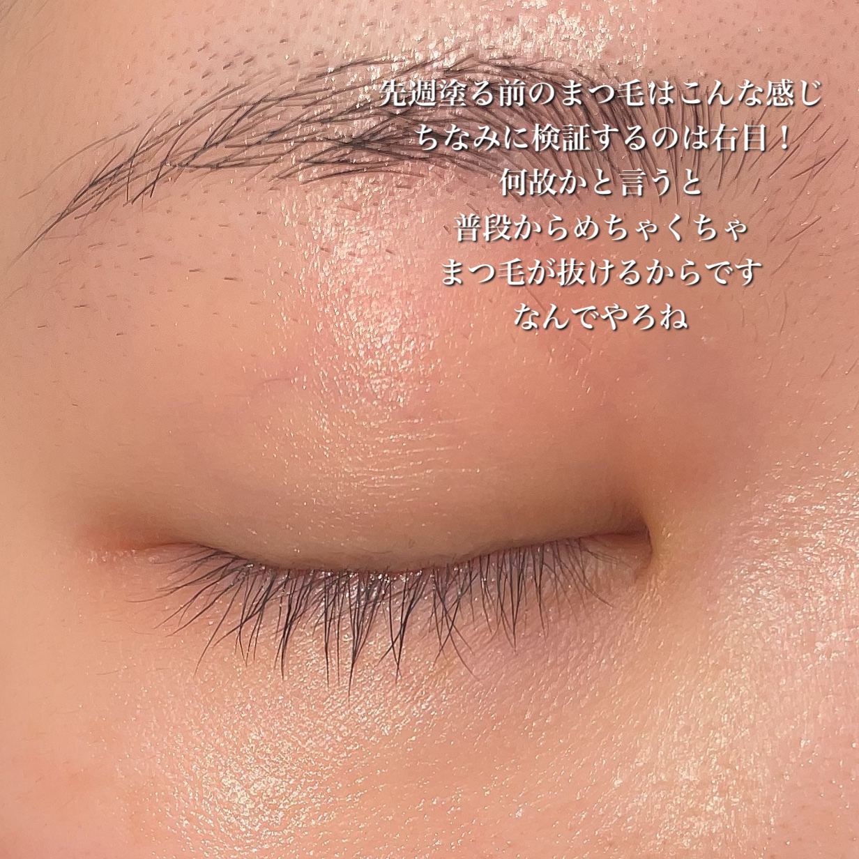 FEG  Eyelash  Enhancer/FEG/まつげ美容液を使ったクチコミ（2枚目）