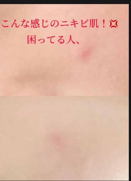 ガラクナイアシン2.0エッセンス/manyo/美容液を使ったクチコミ(1枚目)