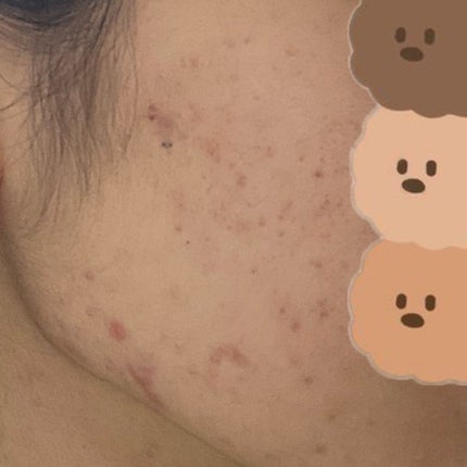 ガラクナイアシン2.0エッセンス/manyo/美容液を使ったクチコミ(4枚目)