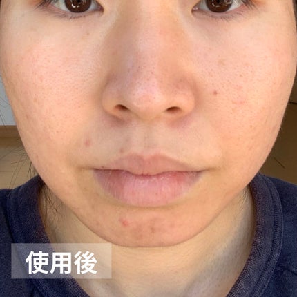 乳液・敏感肌用・さっぱりタイプ/無印良品/乳液を使ったクチコミ(8枚目)