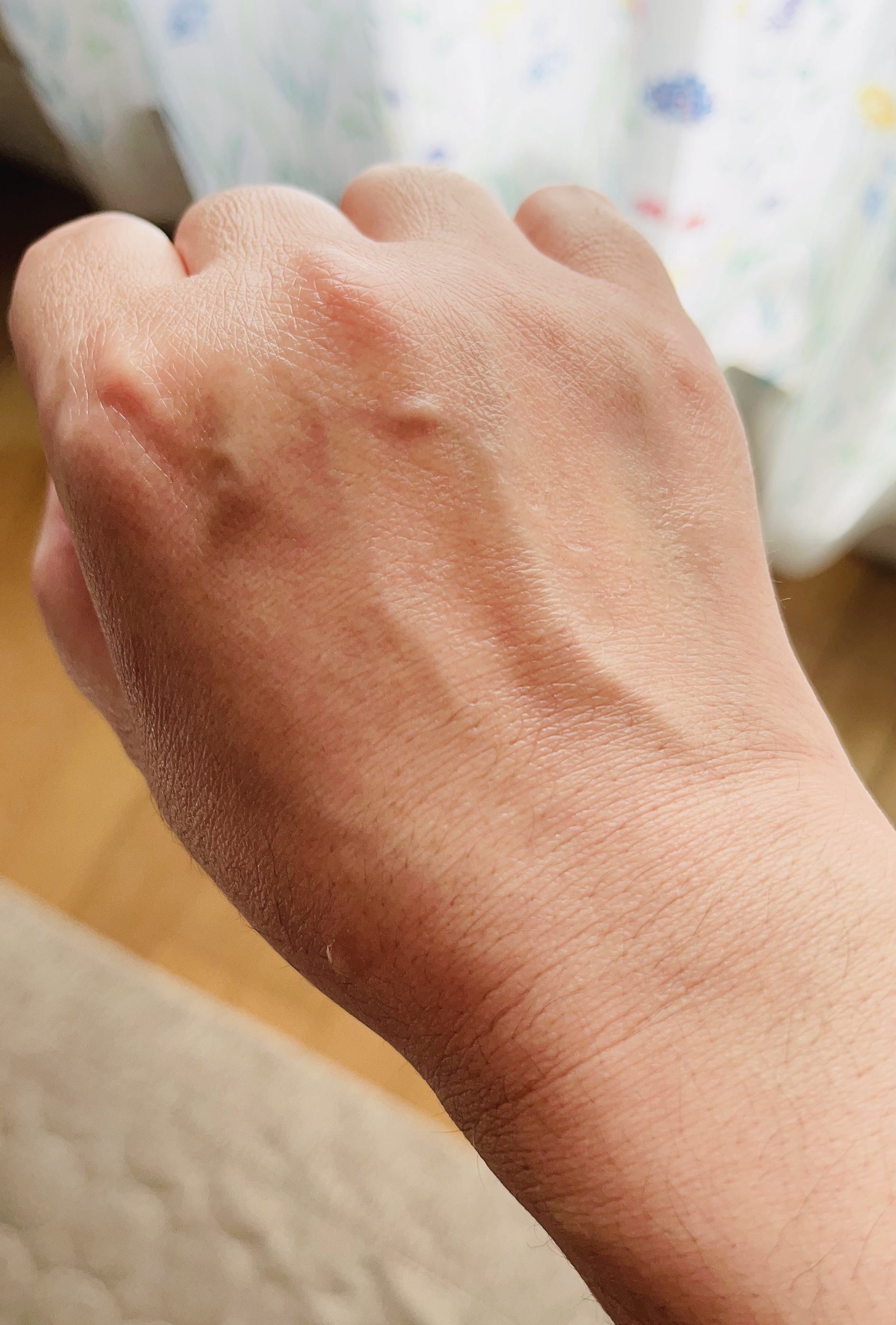 センテラ アンプル/SKIN1004/美容液を使ったクチコミ（3枚目）