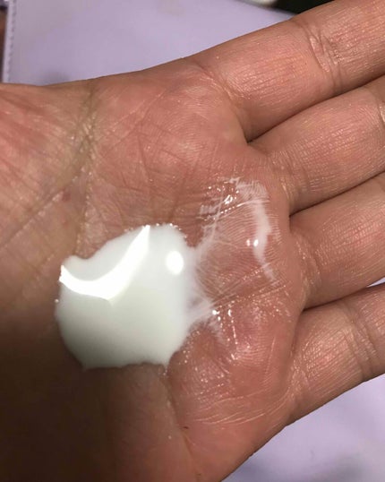 薬用顔ローション/ヘパソフト/化粧水を使ったクチコミ(3枚目)