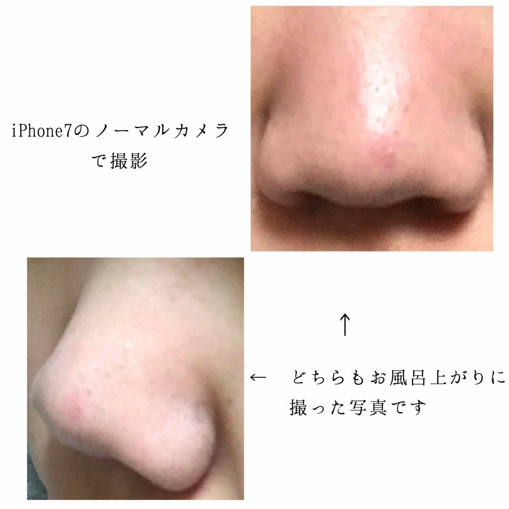 実際 利得 否認する 鼻 の 黒ずみ ベビー オイル 綿棒 Voicebahn Jp