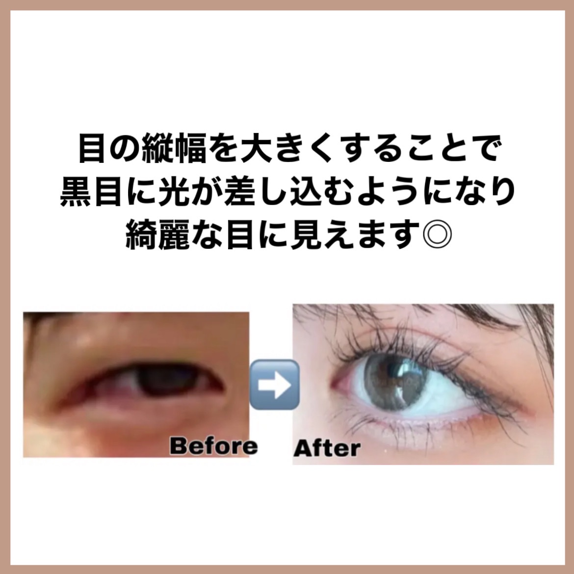 ハトムギ保湿ジェル(ナチュリエ スキンコンディショニングジェル)/ナチュリエ/美容液を使ったクチコミ（3枚目）