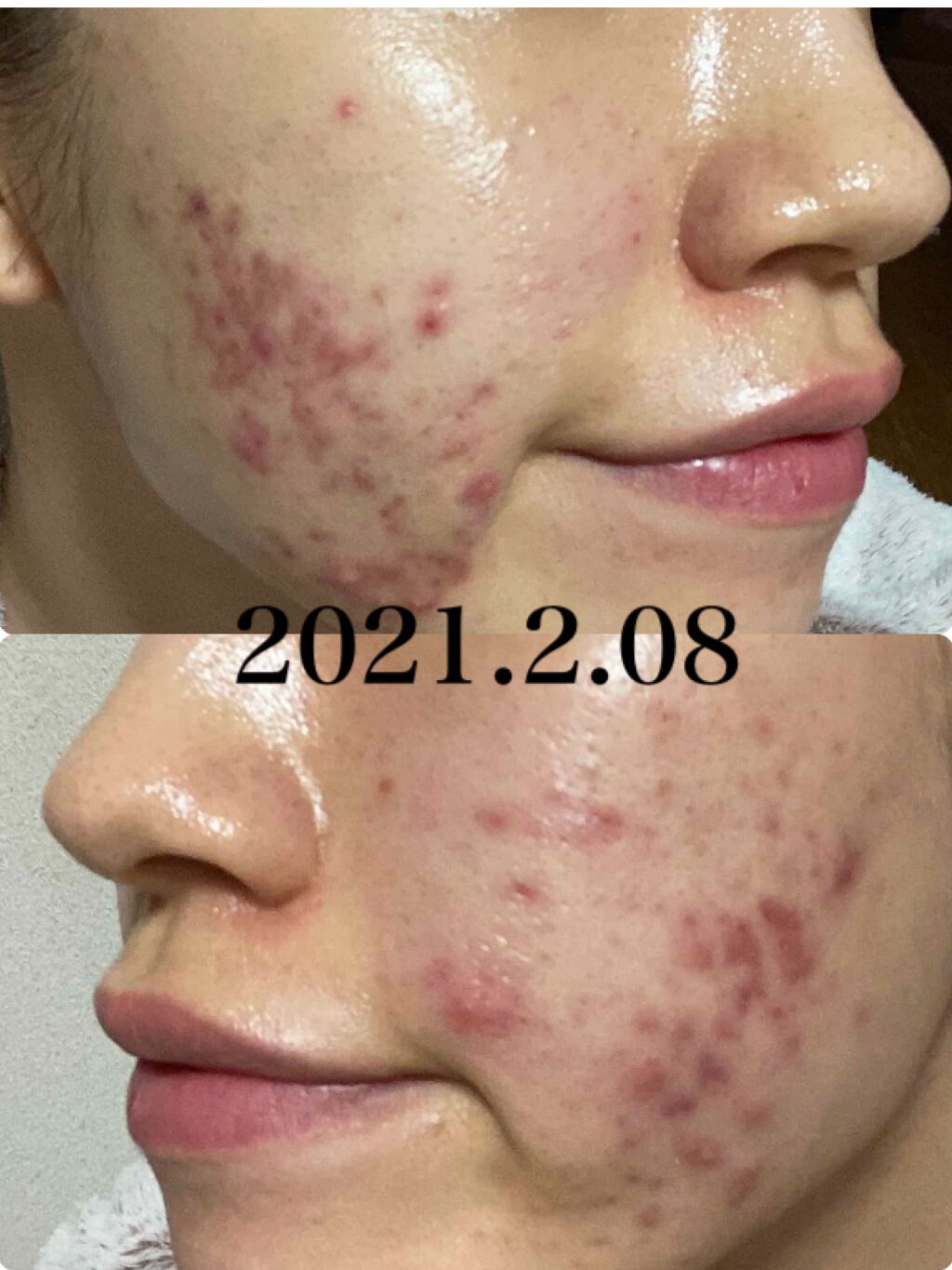 ロゼット 洗顔パスタ 白泥リフト/ロゼット/洗顔フォームを使ったクチコミ(3枚目)