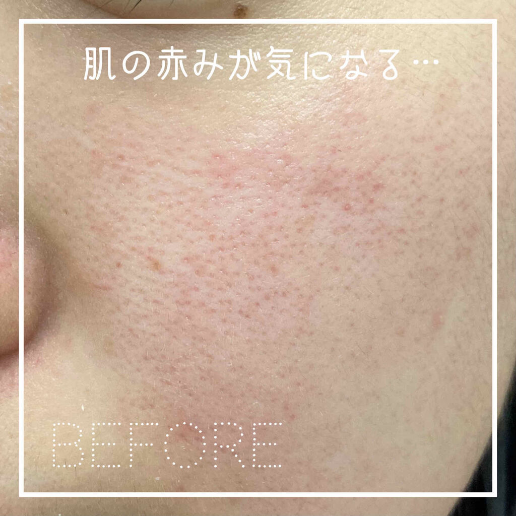 MEDIHEAL I.P.IライトマックスAPマスクEXのクチコミ「透明感と艶感が欲しいならメディヒール！
メディヒールi.p.iのレビューです！

メディヒール.....」（2枚目）