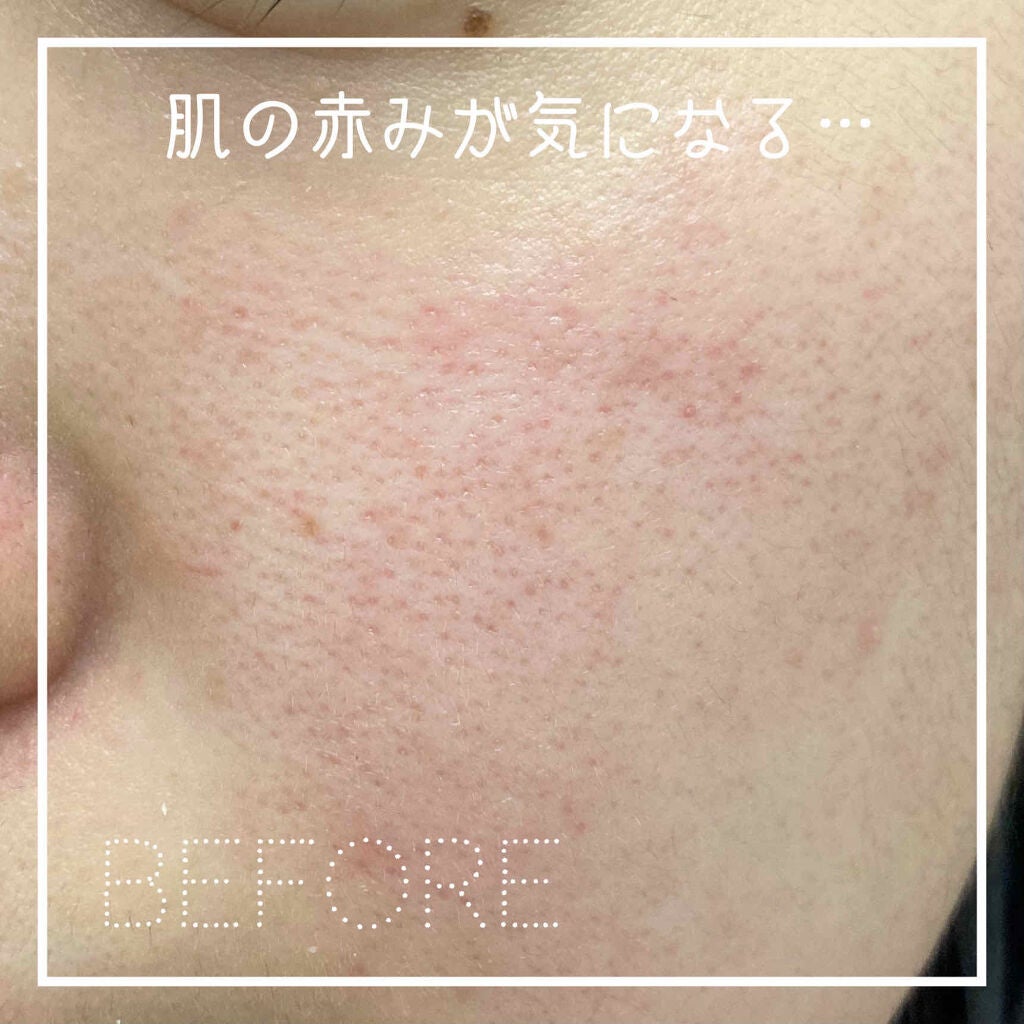 I.P.IライトマックスAPマスクEX/MEDIHEAL/シートマスク・パックを使ったクチコミ(2枚目)