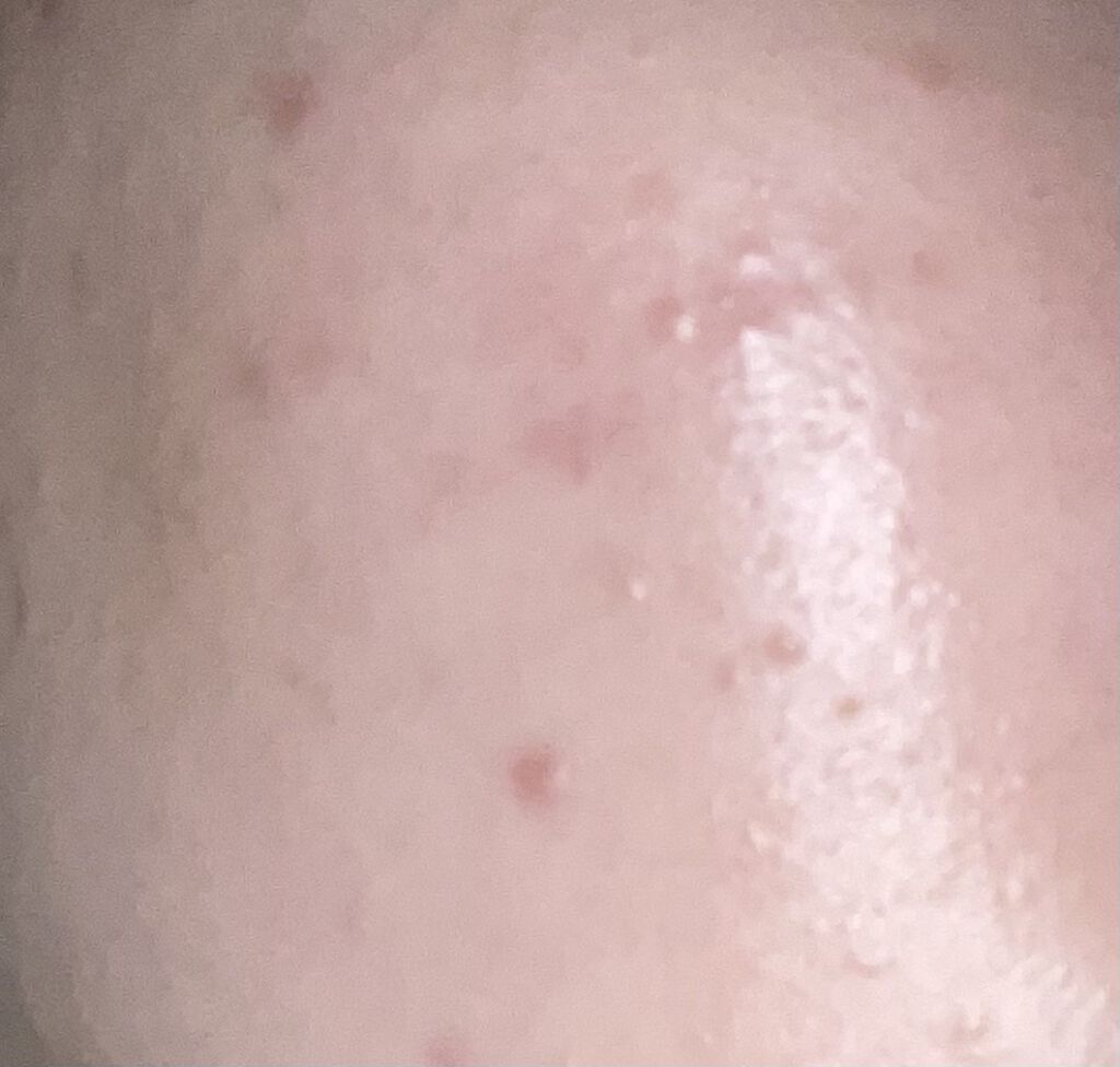 潤浸保湿 化粧水 III とてもしっとり/キュレル/化粧水を使ったクチコミ（2枚目）